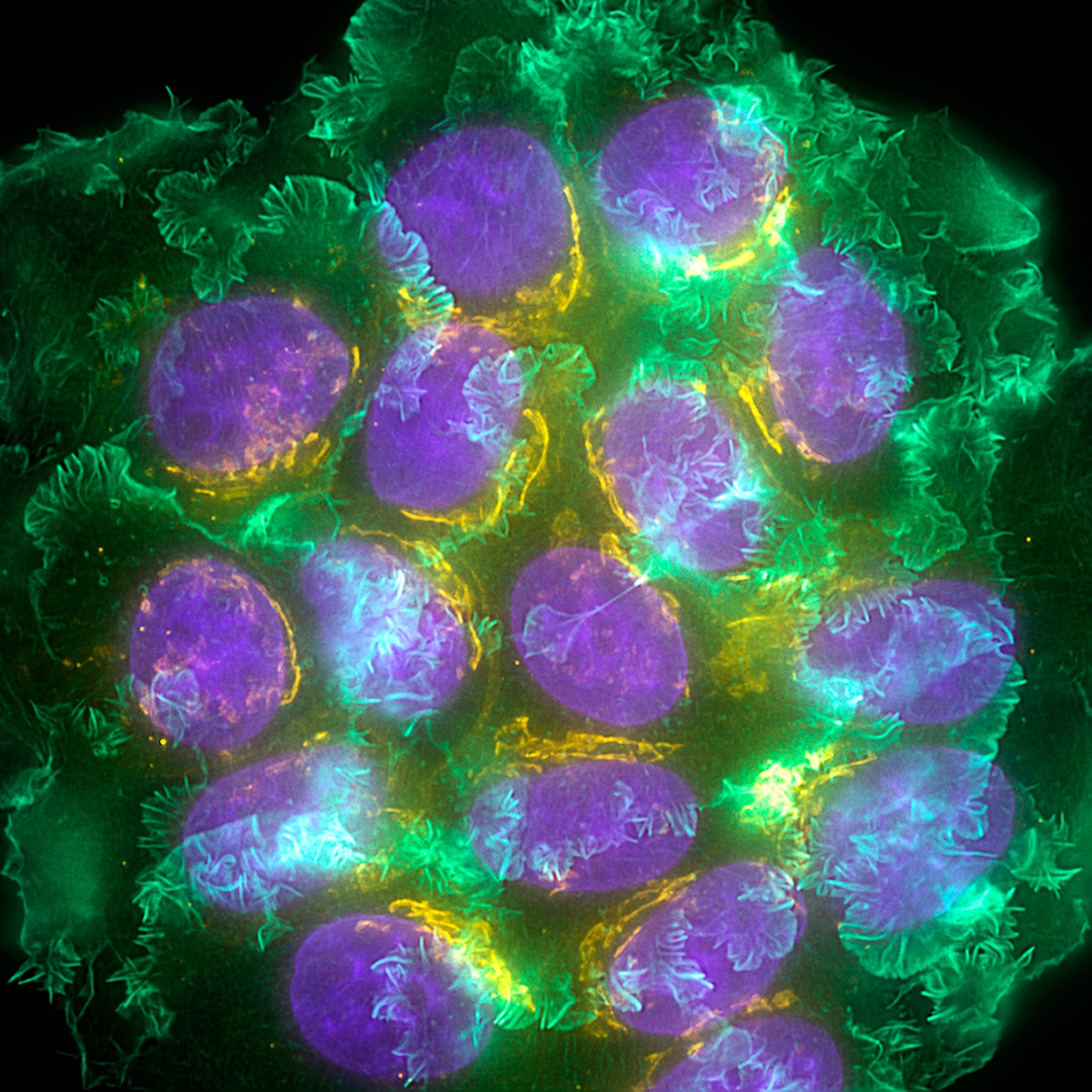 A micrographic view of a clump of glowing cells. Round, purple nuclei are seen with each cell, beside wavy yellow Golgi apparatus structures. Actin filaments glow green and appear like frills adorning the outsides of cells.